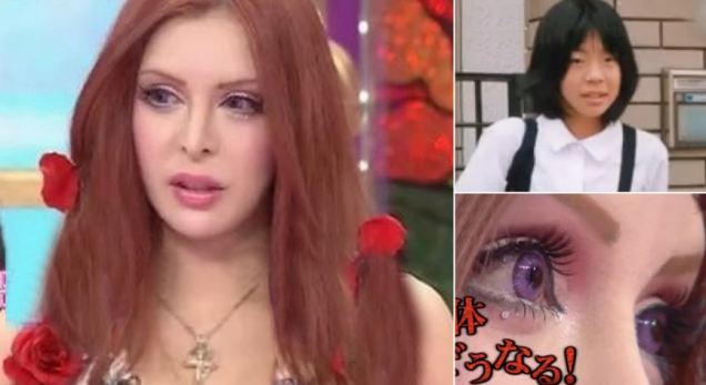 Model Jepang Operasi Plastik US$102 Ribu Ingin Mirip Boneka Prancis